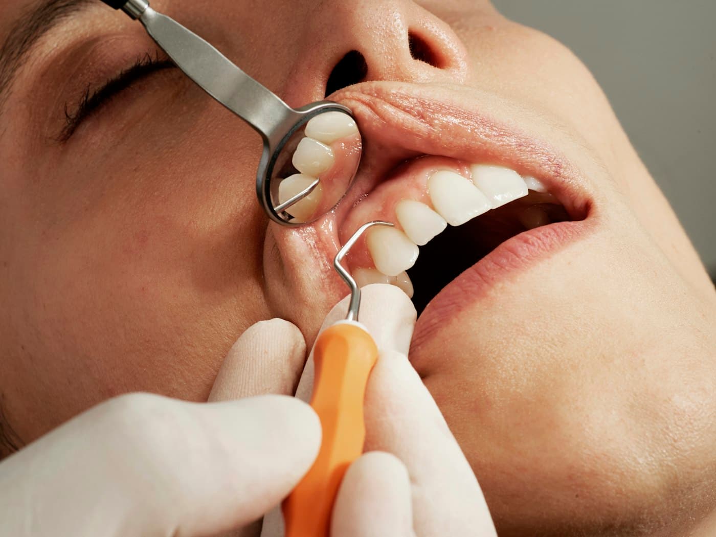 Close clinical view of a gum health examination
