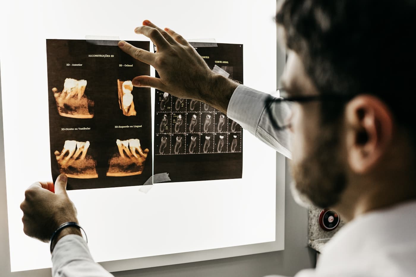 Clinician reviewing dental scans on a light box