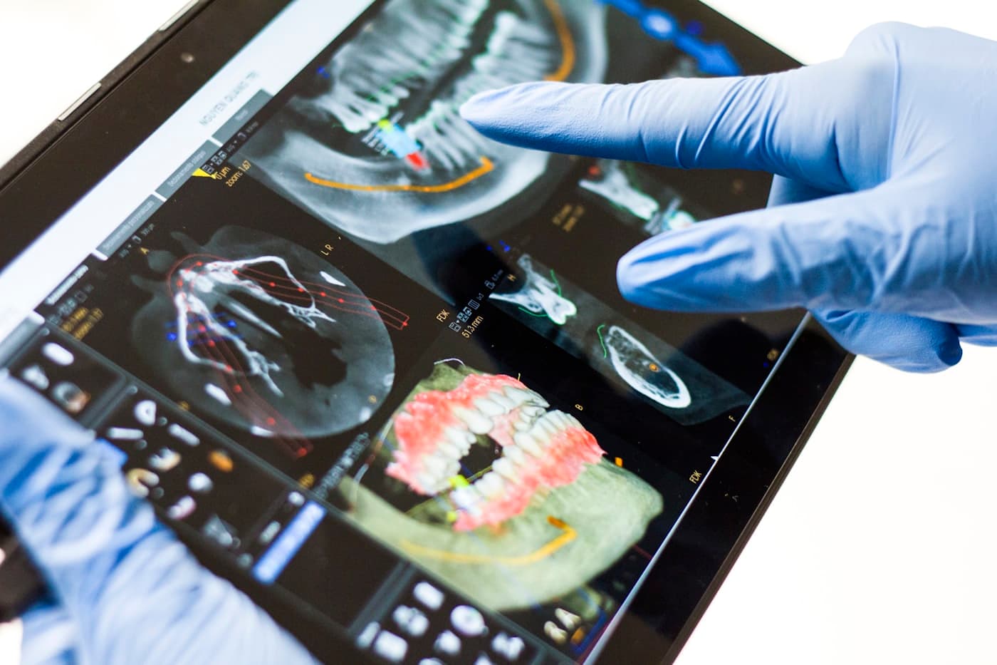 Clinician reviewing a dental scan on a tablet